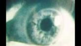 Embedded thumbnail